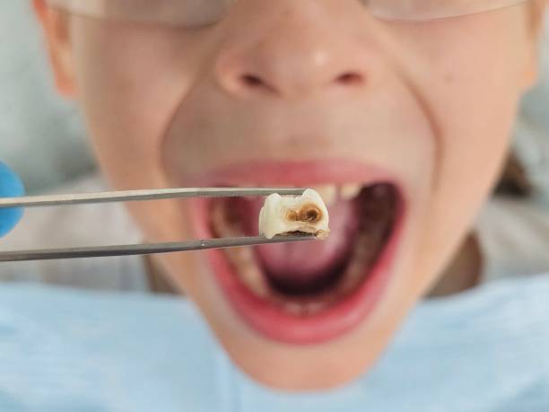 Best Emergency Pediatric Dental Care in Nett, MO